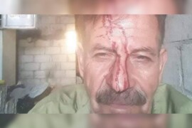 ميليشات قسد تعتدي بالضرب على  أحد المعلمين في الحسكة