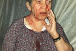 ميليشات pyd_pkk تعتدي على رجل وزوجته  بالضرب .