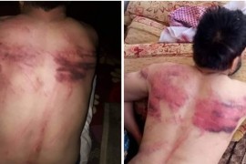 ميليشيات قسد و على خطى نظام الأسد المجرم تستخدم ابشع أنواع التعذيب ضد معتقلين في سجونها .